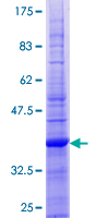 12.5% SDS-PAGE Stained with Coomassie Blue.